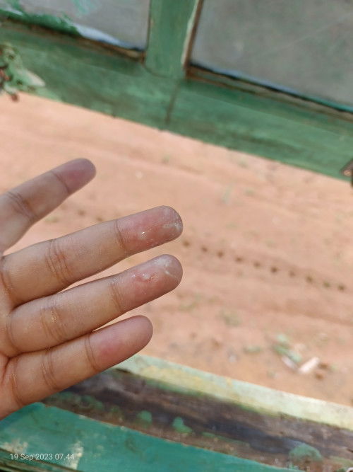 Bunda2 ada gak udah hamil 33 minggau tapi almat kelamin bau kyk terasi bantu jawab lh