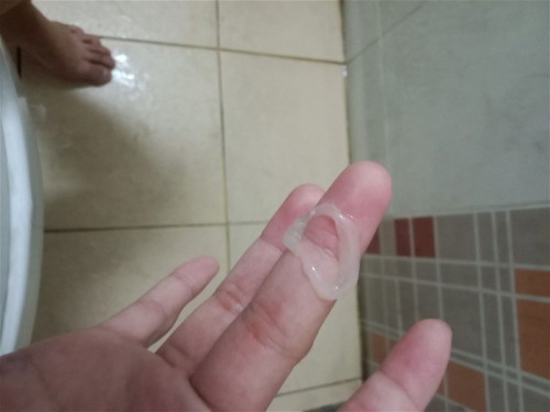 มีใครรู้บ้างว่าคืออะไรค่ะ ออกจากช่องคลอด อันตรายไมกลัวมากค่ะ ท้อง15+4