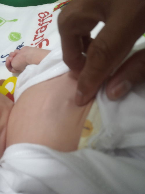 TANONG LANG PO BAKA MAY SAME CASE SAINYO MGA MOMMIES, NORMAL LANG PO BA YUN SA NB? FTM PO.