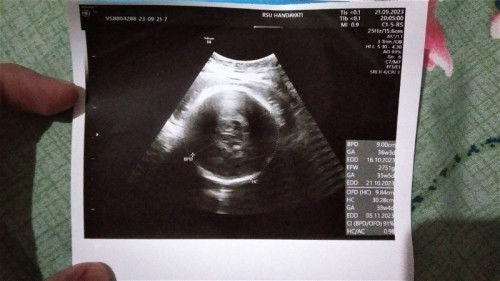 Usg ke 4/Usg trakhir ❤