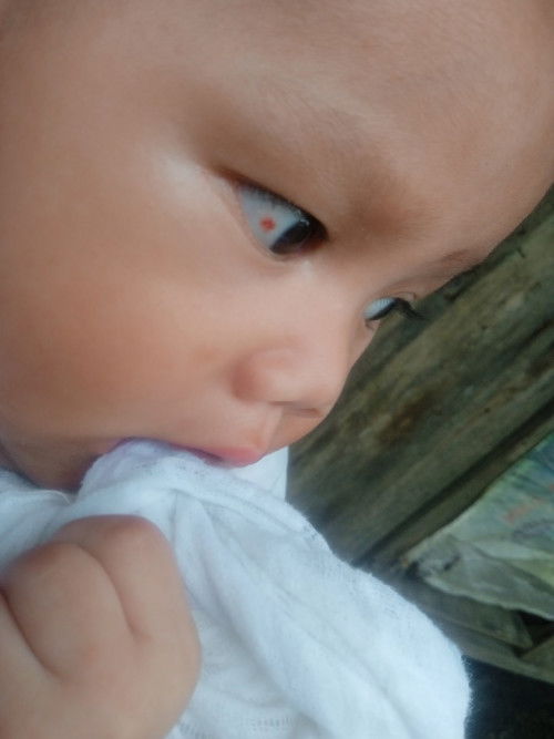 Natusok ang mata ni baby