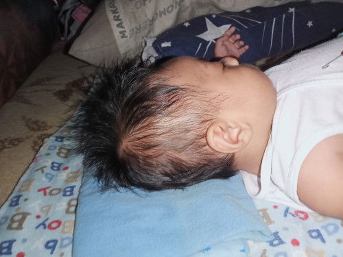 Shape ng head ni baby