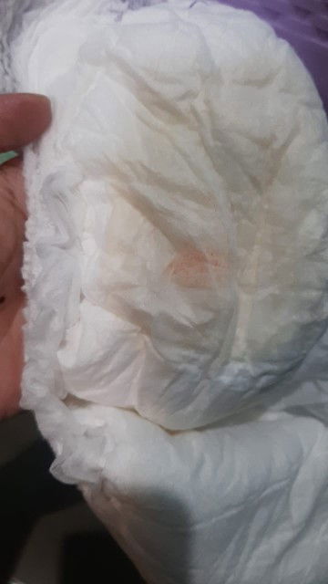 Bercak kemerahan di pampers