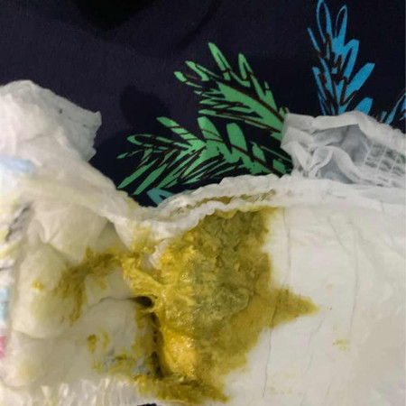 Pup bayi warna hijau , tumben banget knpaa ya , btw bayi 3 Bln asi+sufor