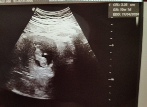 ALHAMDULILLAH BABY MEMBESAR DENGAN SIHAT