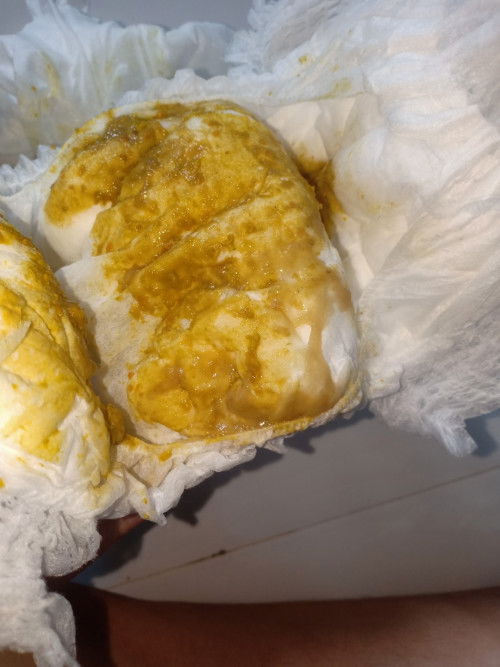 Pup bayi 9 bulan berlendir dan seperti ingus itu kenapa ya?. Maaf fotonya jorok 🙏