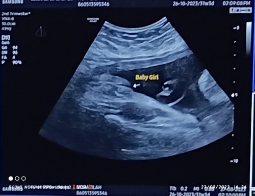 gambae scan gender