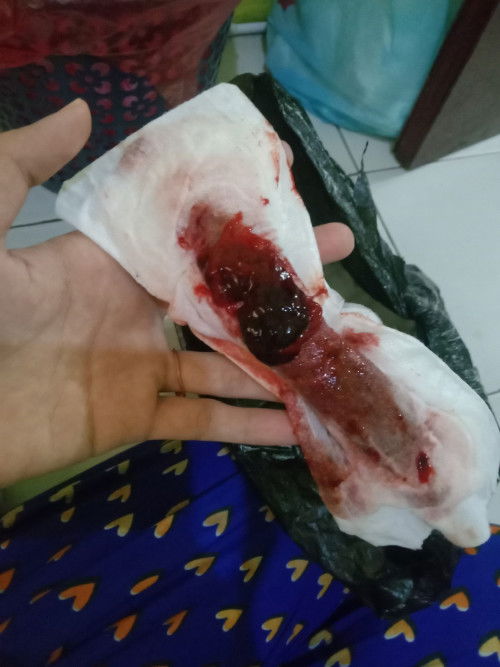 Nifas pasca bersalin