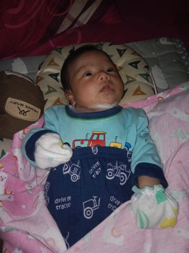 Bahayakah bedak untuk bayi