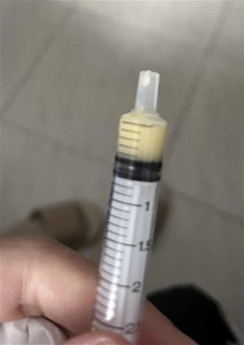 Colostrum too little to feed
