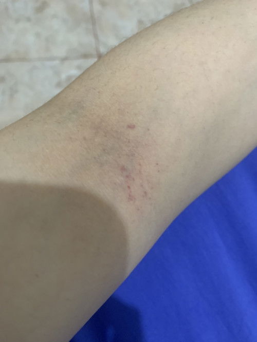 Hamil 18mnggu ada bercak dikulit