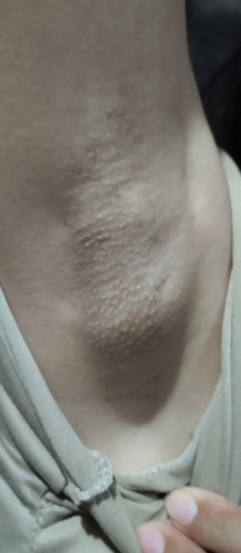 Natural lang ba maitim ang kili2x tapos pinapawisan and may amoy siya.Tapos may bukol na tumubo?