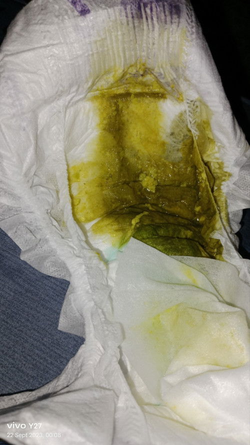 Bayi 1 Bulan berak hijau lendir