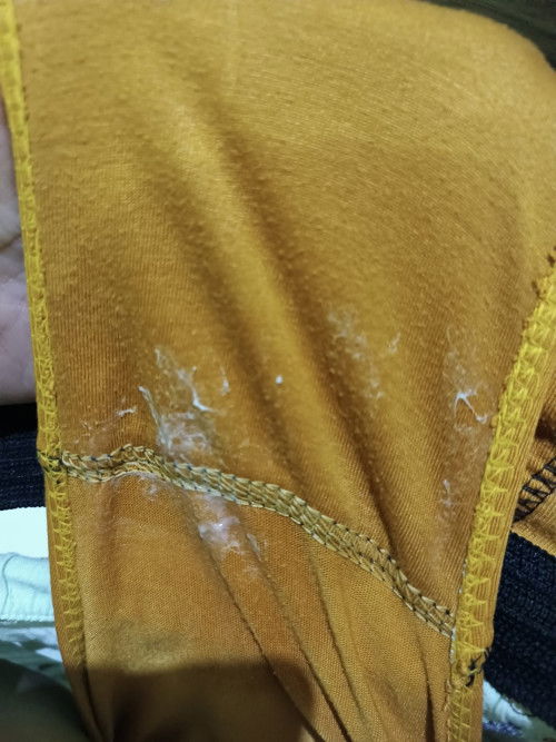 Kehamilan 9w 5hari keputihan