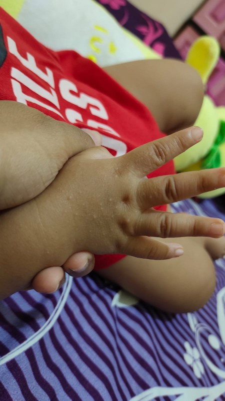 Bintik putih kecil