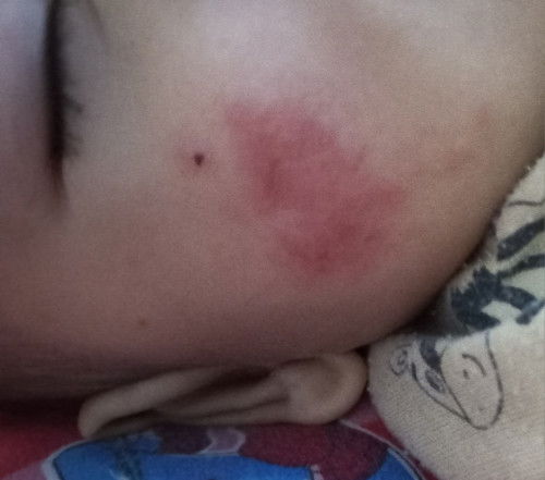 Pipi bayi 8 bulan merah