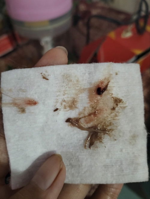 Flek usia 10 minggu 3 hari