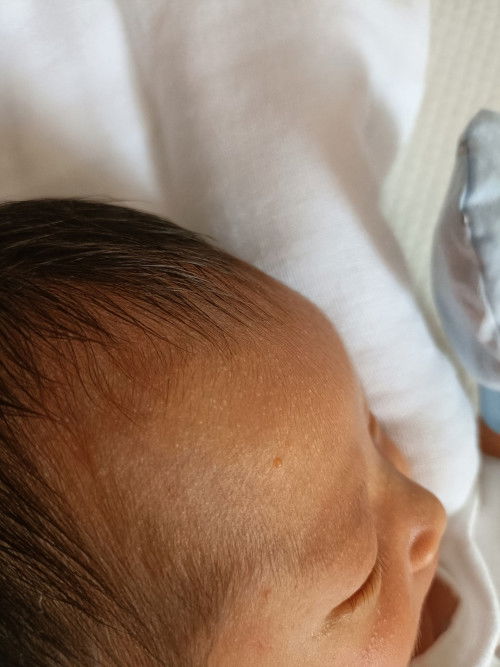 bé nhà em đc 7 ngày . bé bị nổi như vậy .em phải làm sao v các mom