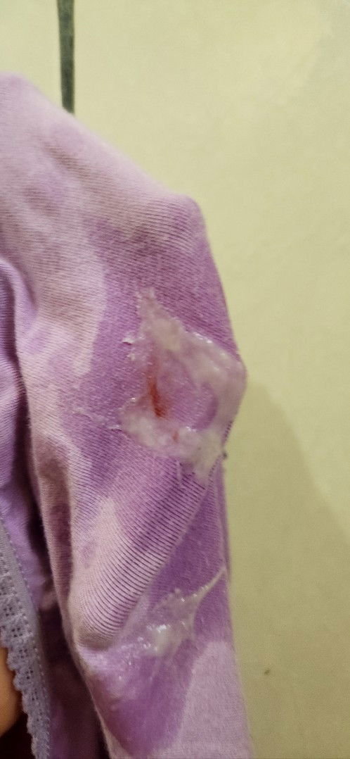 Last period 16/07/23 upt 3 kali (1 +ve, 2 -ve) tiba2 hri ni ada tanda mcm ni. Ini darah apa ya?