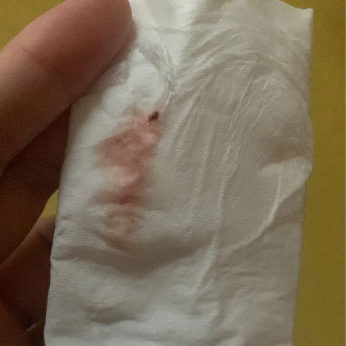 Flek darah di usia 39 minggu 6 hari