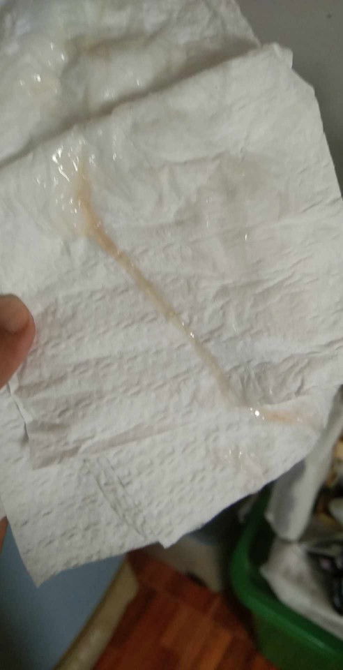 ตั้งครรภ์39วีคไปกระตุ้นตอน38+5มีมูกใสออกมาตลอดวันนี้เป็นมูกเลือด