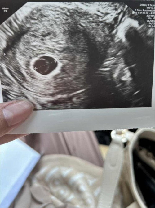 7 weeks baru kantong