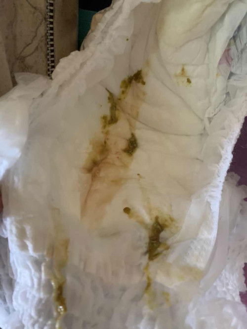 ciri2 diare pada anak 9 bulan