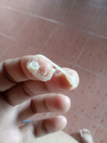 แบบนี้ปกติไหมคะ ไม่ปวดท้อง ไม่มีเลือด ไม่มีน้ำเดิน  ปากมดลูกเปิด1.3ซ.ม.  38+1week