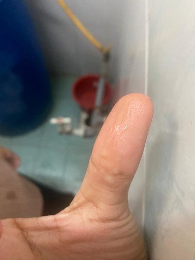 Hye Mummy semua. Berapa hari ni setiap kali saya buang air kecil ada lendir macam ni keluar.