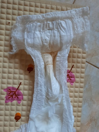 Warna air kencing bayi
