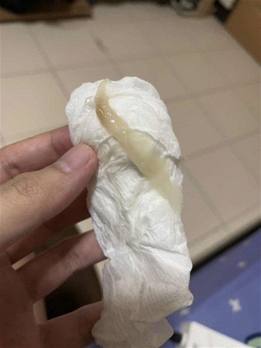 มีมูกไหลออกแบบนี้ ไม่มีเลือดปน ไม่เจ็บท้อง หมอกระตุ้นให้เมื่อวันศุกร์ที่ผ่านมา ควรไปหาหมอไหมค่ะ  อายุครรภ์38 week