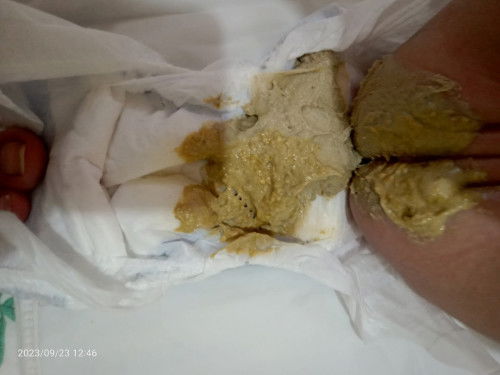 From enfamil catch up to enfamil Gentlease.. mga mommies ganito din ba pupu ng baby nyo sa Gentlease