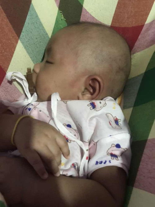 ลูกน้อยแพ้นม🍼