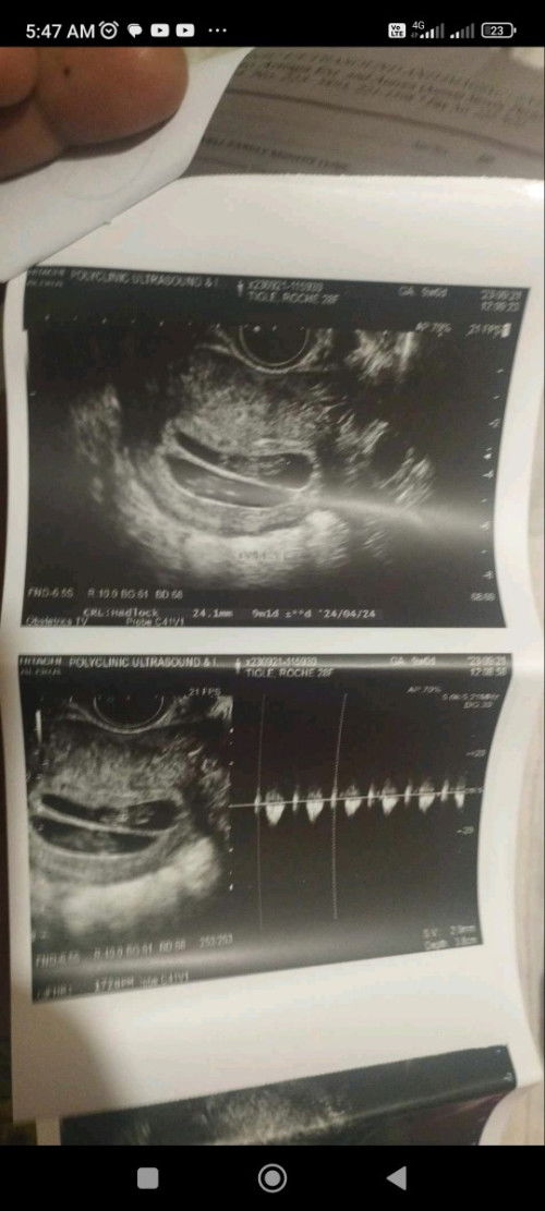 madalas bang magsusuka pag twins ang baby??