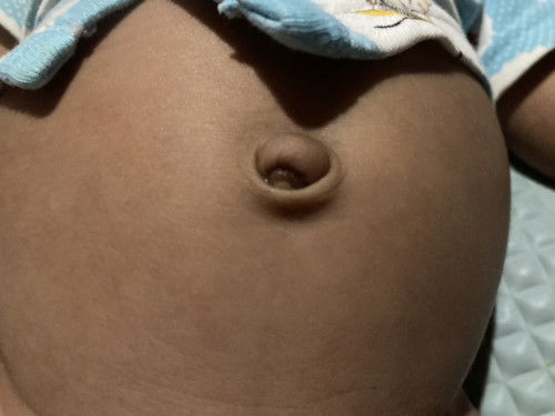 Pusod ni baby????