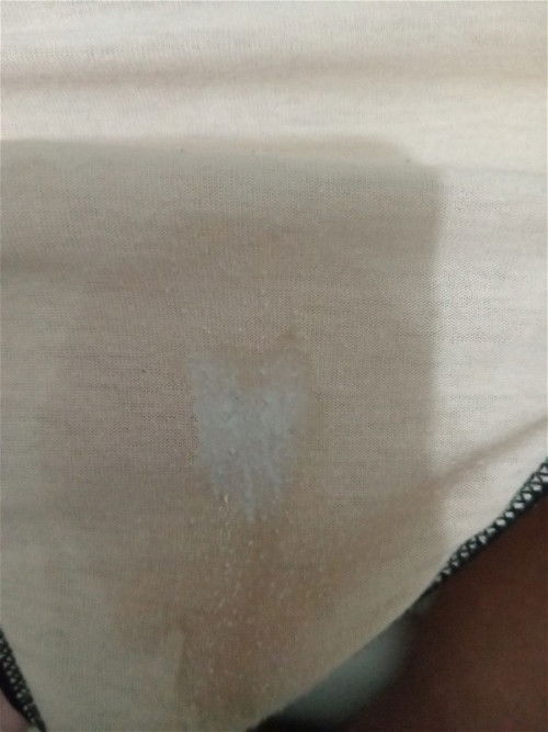 36 weeks and 3 days may white discharge at parang ihing kasama