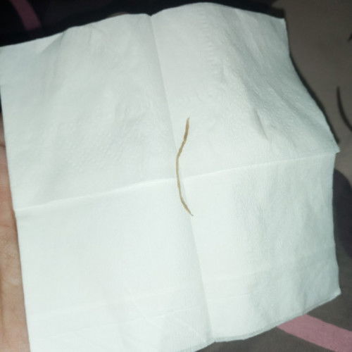 Keluar benang pasca SC