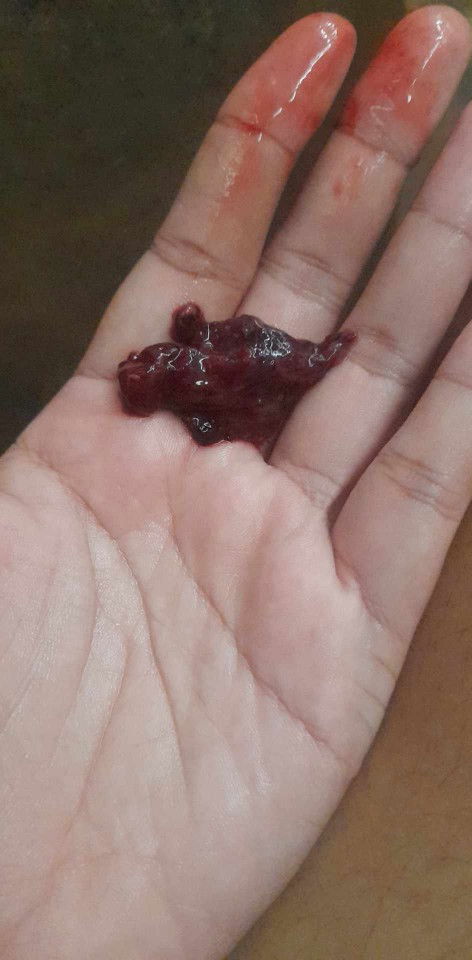 คุณแม่หลังคลอด