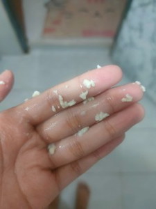 ตกขาวเป็นเม็ดแป้งมีอาการคัน