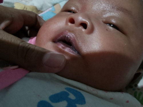 Assalamualaikum... Bunda ada yg sam tidak dengan saya anak saya lahir dg kondisi bibir yg hitam ...