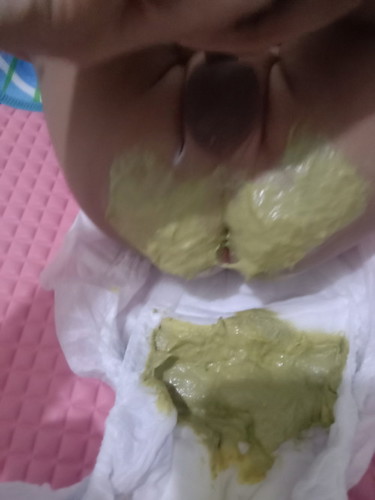 Poop ni baby