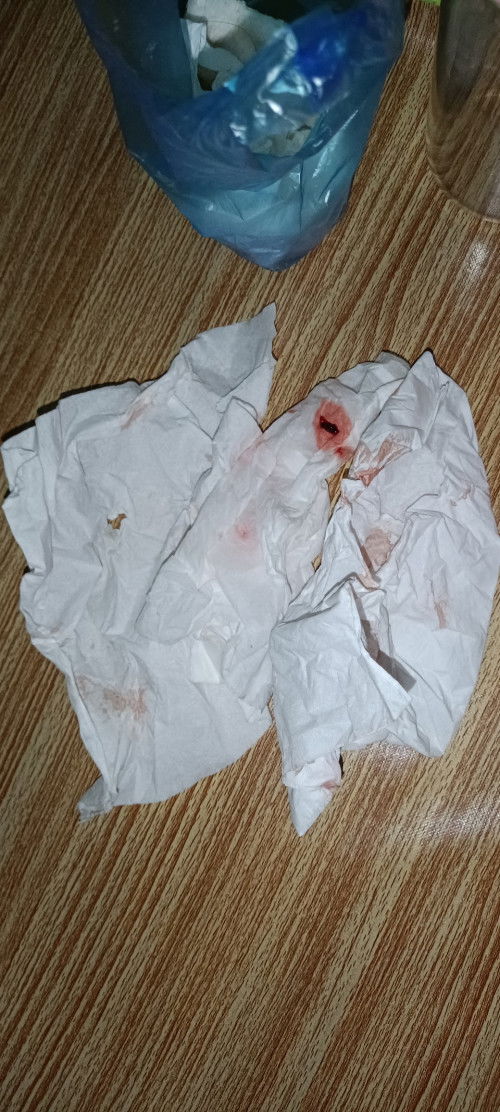 Keluar Darah Saat 5 Week