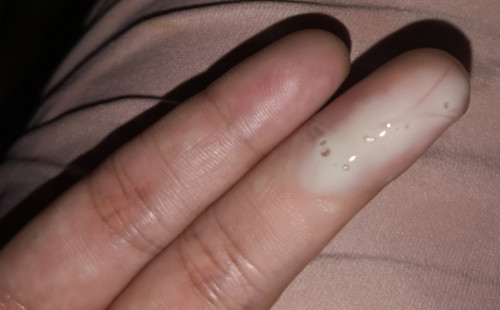 ano po kaya yung lumabas sakin 37w1day