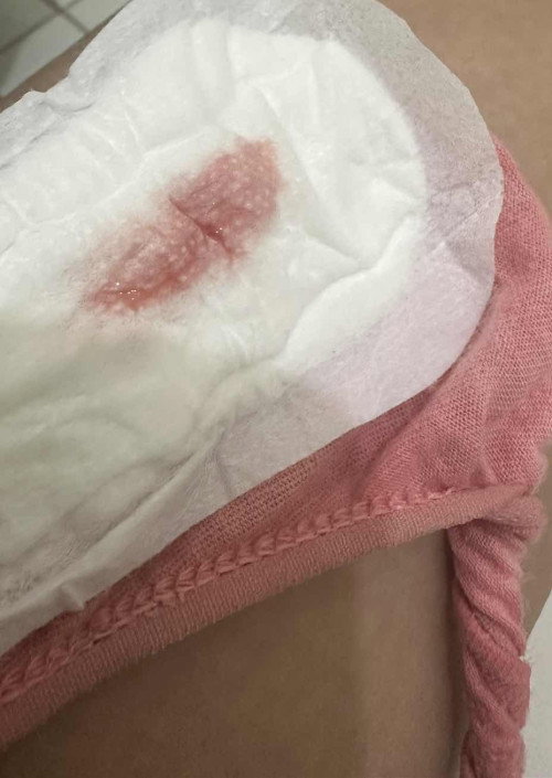 My blood po ako lumabas now ano po kaya possible na reason 39weeks napo ako due ko is oct 1