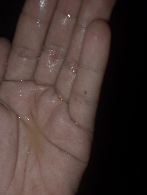 Mau tanya apa ini air ketuban atau apa yah??bau nggak Pesing Mala kayak amis gitu🥺