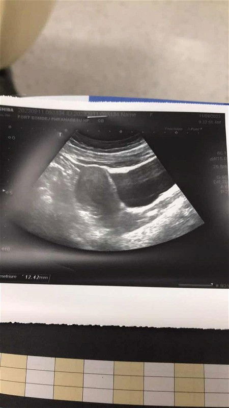 สอบถามแม่ๆหน่อยค่ะ