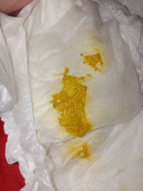 อึเเบบนี้ปกติไหมคะ