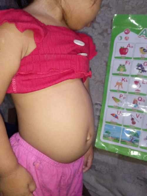 Mga mhie tanong ko lng po normal lng poba Yung Laki ng tiyan Ng anak Kong 2years old