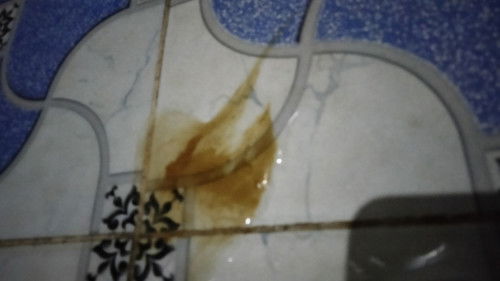 Flek di Usia kandungan 3 Bulan.