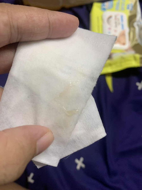 มูกใสหรือตกขาวคะแบบนี้